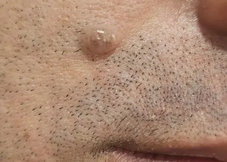 שומה בפנים